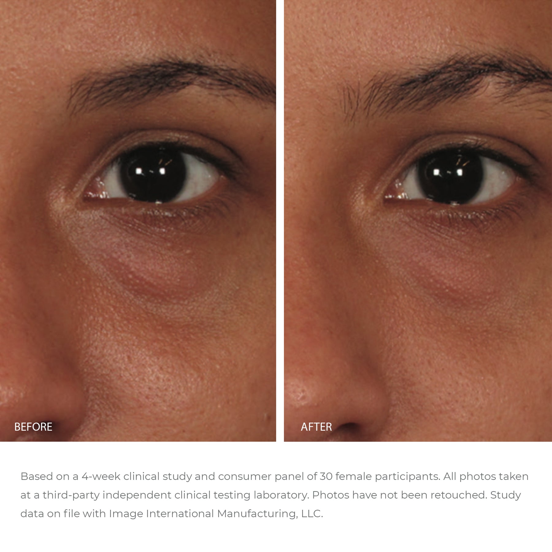 ORMEDIC Balancing Eye Lift Gel .1oz Samples (5 pack)