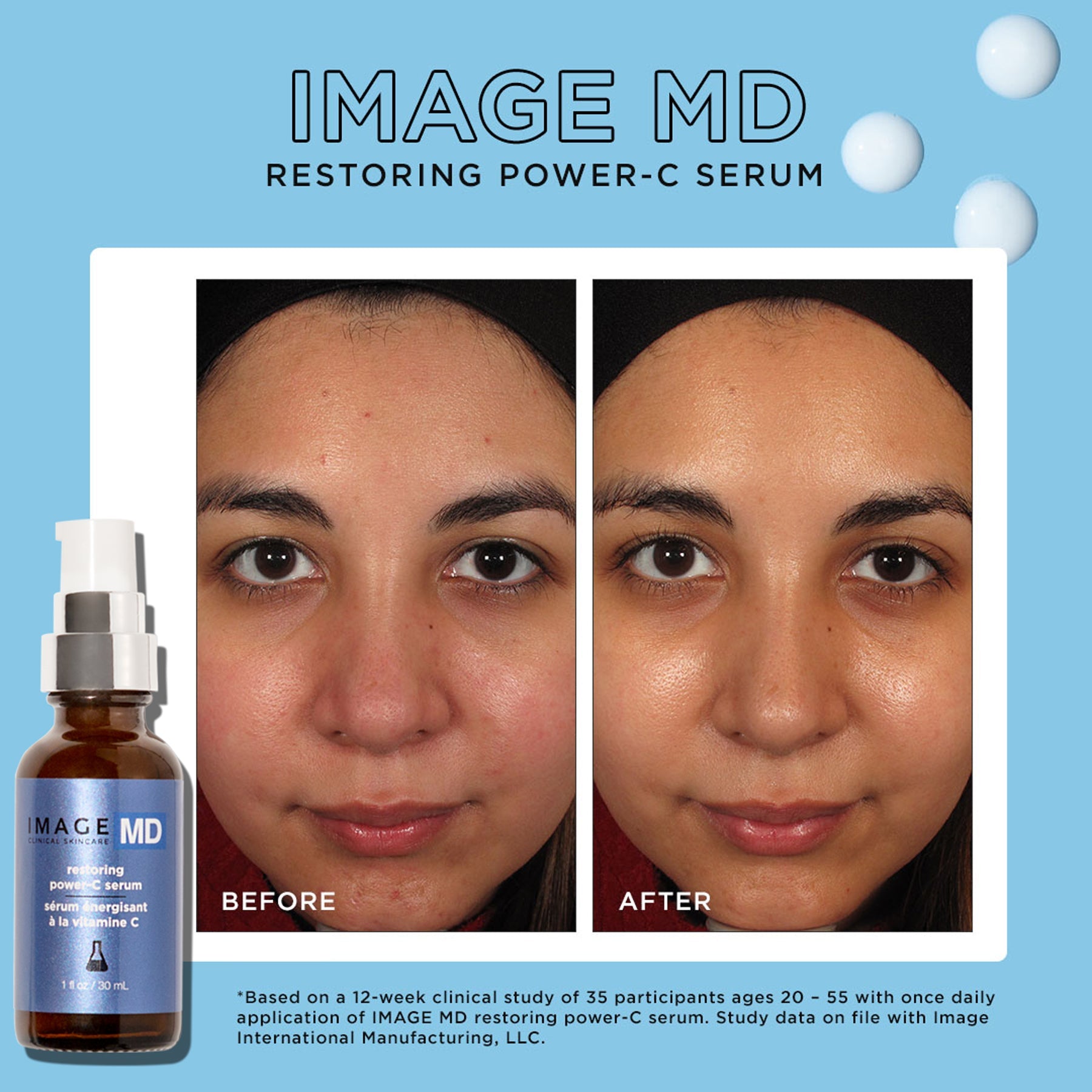 IMAGE MD® restoring power C serum