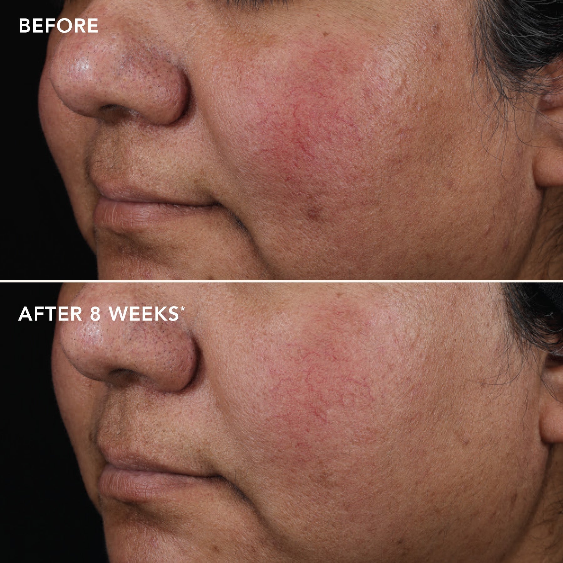 AGELESS+ retinol pure liquid retinol 0.75% (tester)