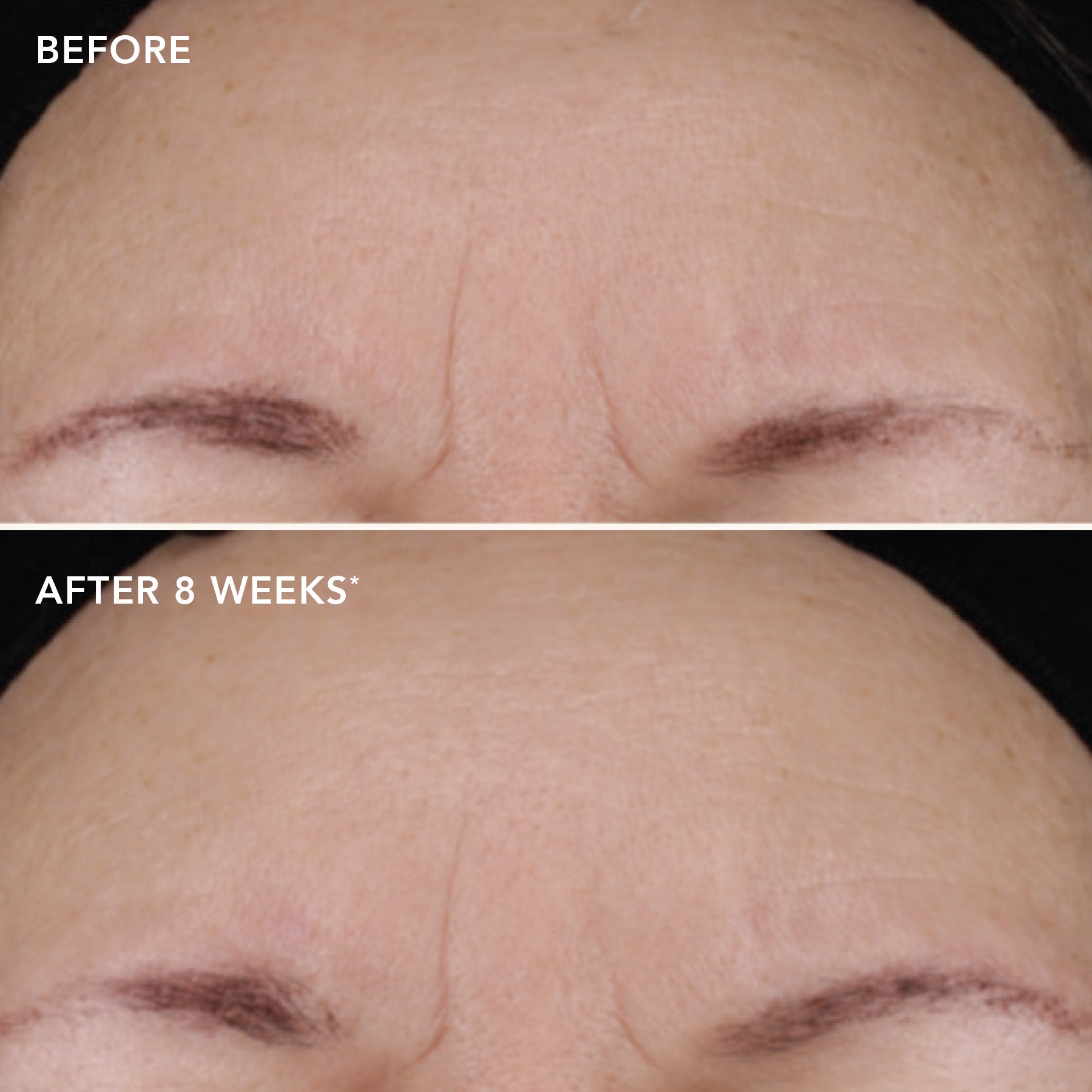 AGELESS+ retinol treatment crème 1.2% retinol complex (samples 5-pack)