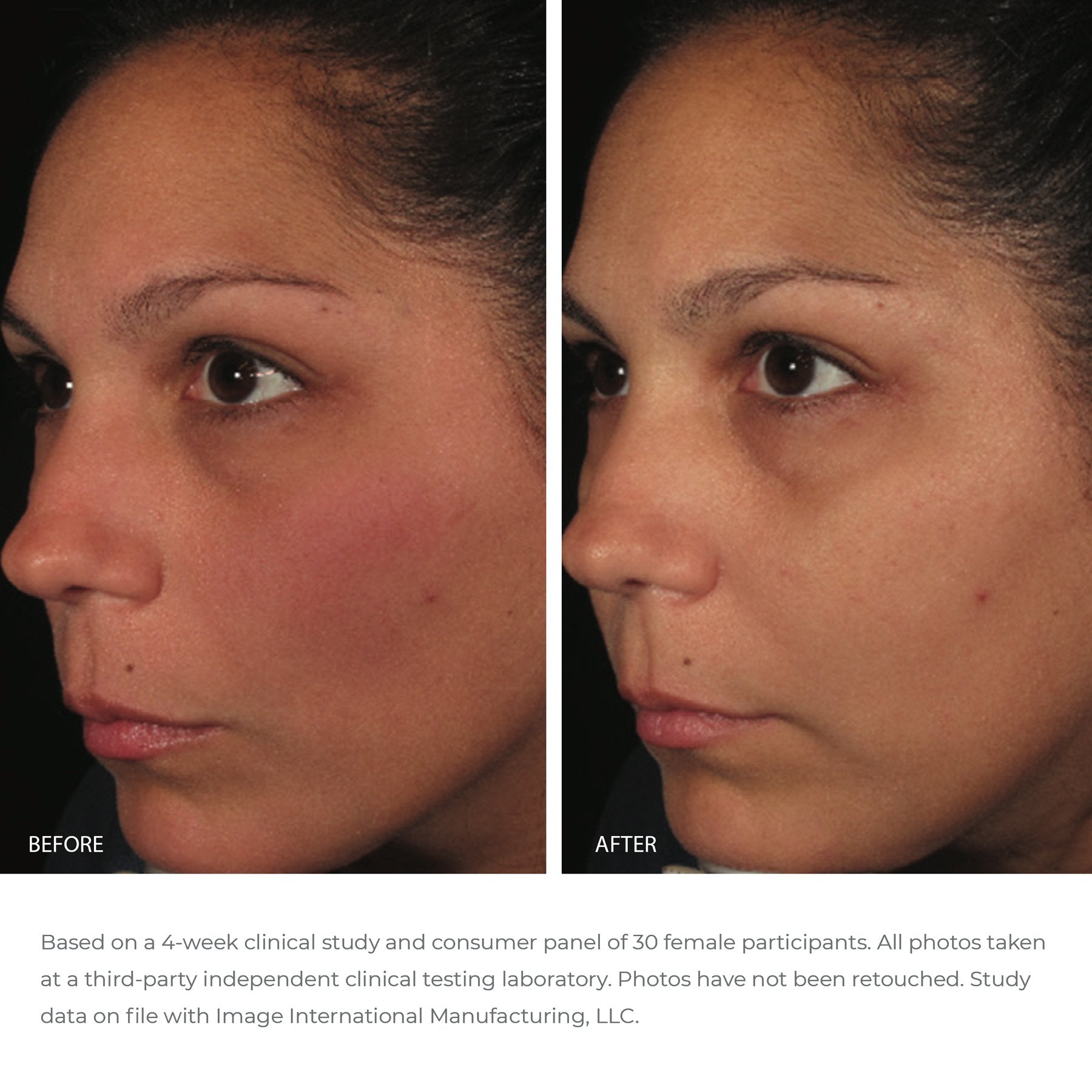 ORMEDIC®  balancing antioxidant serum (samples 5-pack)
